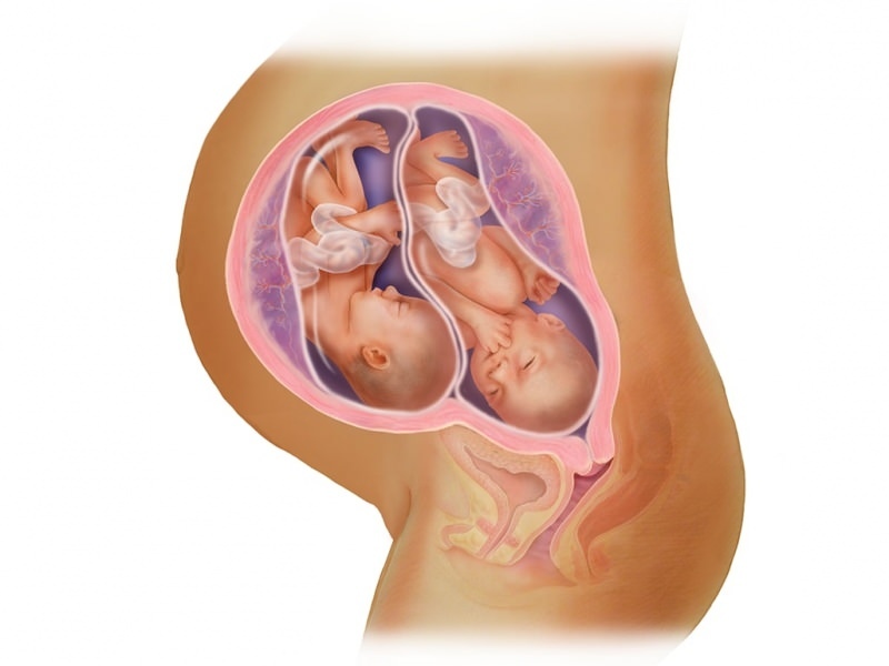 Dvojité tehotenstvo v IVF! Čo je prenos embryí?