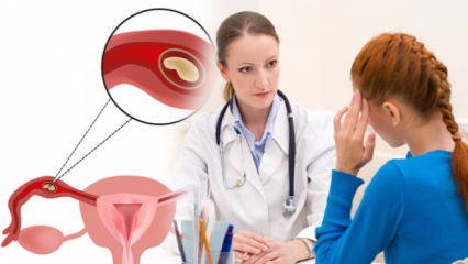 Čo je mimomaternicové tehotenstvo (mimomaternicové tehotenstvo)? Aké sú príznaky mimomaternicového tehotenstva?
