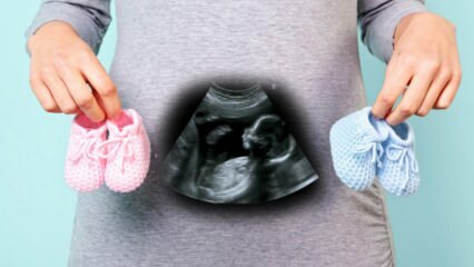 Bude sa pohlavie dieťaťa určovať v prvom trimestri tehotenstva?