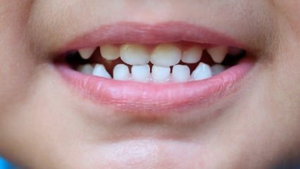 Ako učiť deti zubnú starostlivosť?