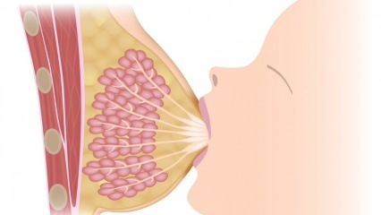 Čo je mastitída (zápal prsníkov)? Príznaky mastitídy a liečba počas dojčenia