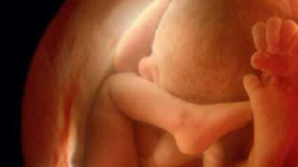 Nezobrazovanie pohlavia dieťaťa na ultrazvuku! Ako vyzerajú malí chlapci a dievčatá na ultrazvuku?