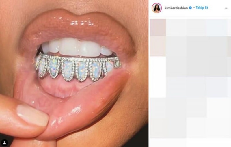 Zubný klenot Kim Kardashian v hodnote 5 000 dolárov
