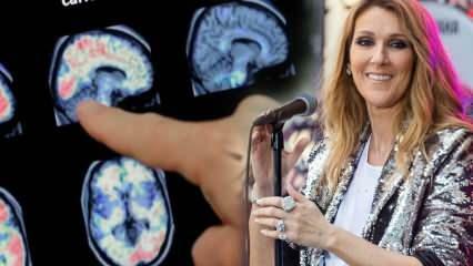 Čo je syndróm stuhnutej osoby? Celine Dion