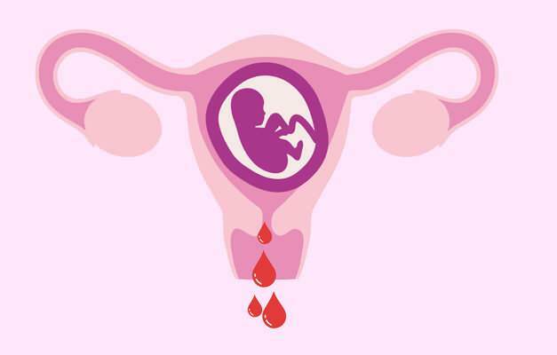 príčiny krvácania počas tehotenstva