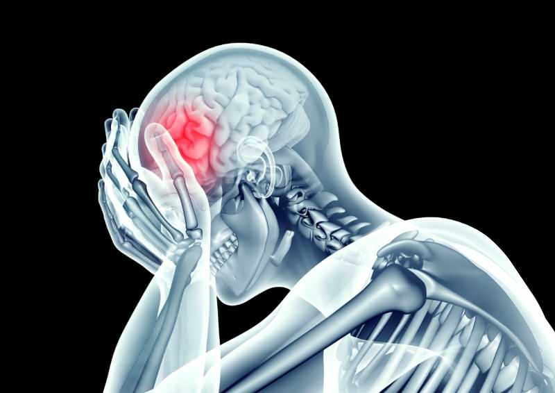 croonavírus poškodzuje mozog zúžením ciev