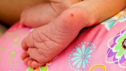 Prečo sa pupková krv odoberá u dojčiat? Požiadavky na testovanie päty krvi u dojčiat