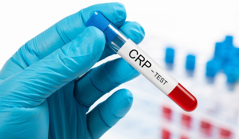 Prečo CRP v krvi stúpa? Čo je to CRP? Ako znížiť CRP?