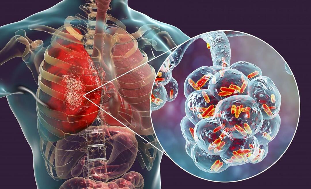 Čo je zápal pľúc a aké sú jeho príznaky? Ako sa lieči nový epidemický vírus pneumónie?