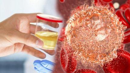 Čo je test na leukocytovú esterázu? V ktorých prípadoch je test na leukocytovú esterázu pozitívny?