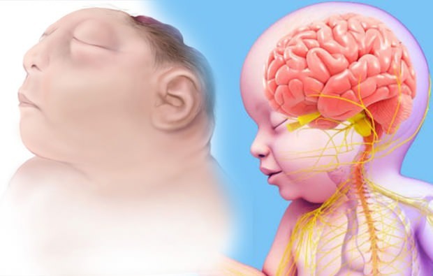 Žije Anencephaly dieťa? Diagnóza anencefálie