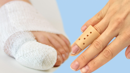Čo spôsobuje zlomenie prstov? Aké sú príznaky zlomenia prstov?