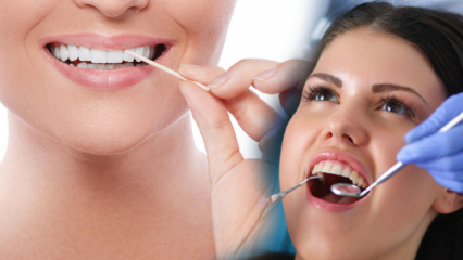 Ako sa chráni zdravie úst a zubov? Čo treba brať do úvahy pri čistení zubov?