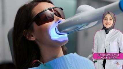 Ako prebieha metóda bielenia zubov (Bleaching)? Poškodzuje metóda bielenia zuby?