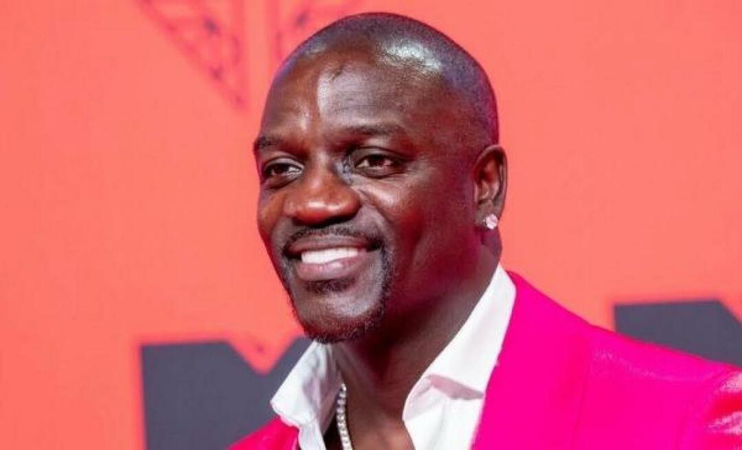 Americký spevák Akon dal pri transplantácii vlasov prednosť aj Turecku! Tu je cena, ktorú zaplatil...