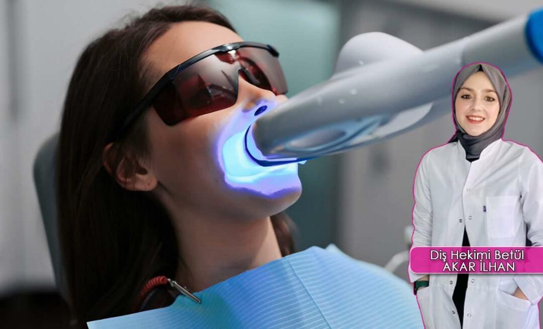Ako prebieha metóda bielenia zubov (Bleaching)? Poškodzuje metóda bielenia zuby?