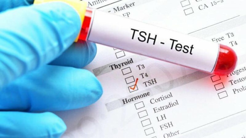 Čo je to test TSH? Aké sú príznaky TSH? Čo znamená TSH vysoká a nízka?