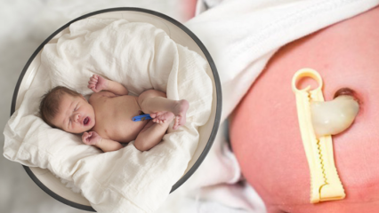 Čo je Placenta Previa? Ako sa starať o pupočnú šnúru u detí? Ak je pupočníková šnúra dlhá ...