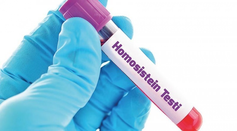 Zvýšenie obsahu homocysteínových látok 