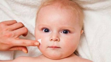 Tipy pre starostlivosť o pleť pre bábätká! Aké sú kožné problémy u detí?