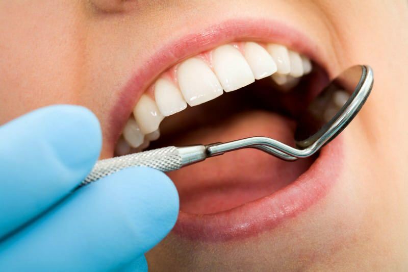 Čo je to ošetrenie zubov? Ako sa má zub?