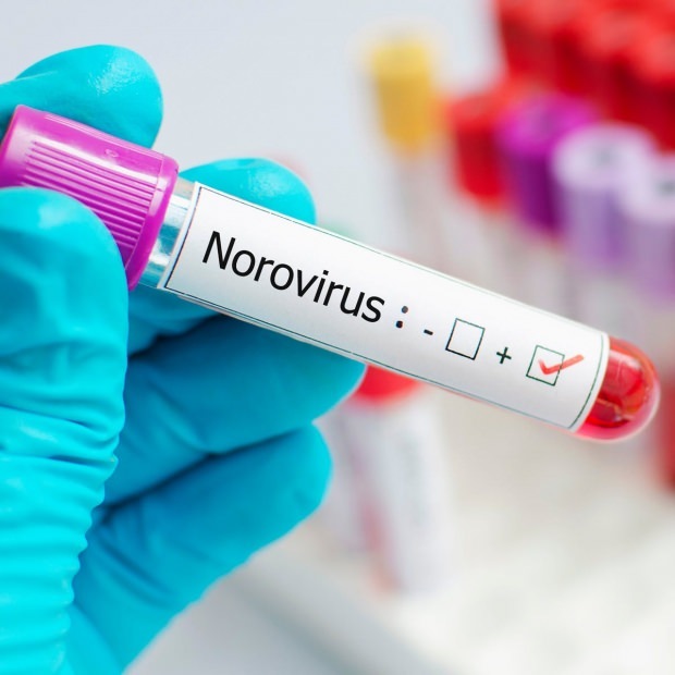 Čo je norovírus a čo spôsobuje choroba