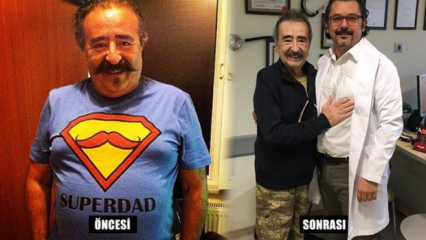 Yildirim Öcek, ktorý podstúpil operáciu žalúdka, zomrel