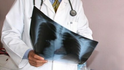 Odborníci oznámili! Zvýšenie úmrtnosti na rakovinu pľúc