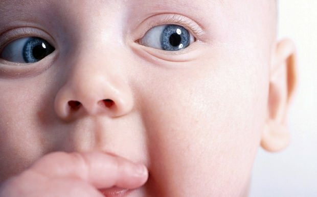 Prečo sa u dojčiat posun očí?