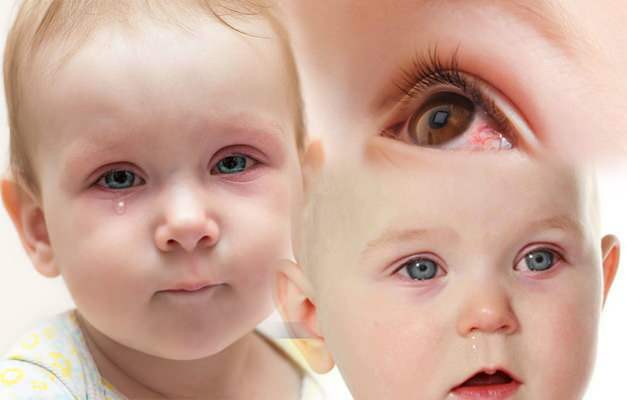u detí spôsobuje krvácanie do očí