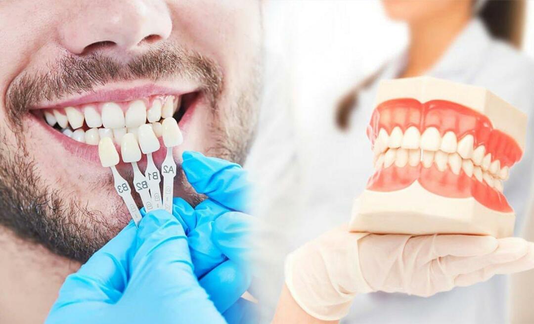 Prečo sa na zuby aplikujú zirkónové korunky? Ako odolný je zirkónový povlak?
