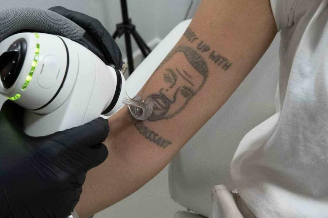 Tetovanie Kanye Westa bude bezplatne odstránené v Londýne 