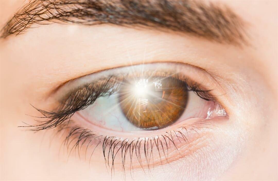 Čo spôsobuje záblesky svetla v oku a ako sa to lieči?