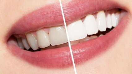 Aké sú odporúčania pre biele zuby? Bielenie zubov prirodzene doma ...