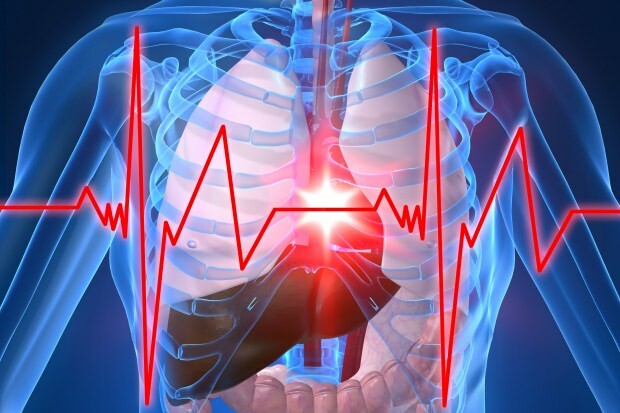 aké sú príznaky infarktu