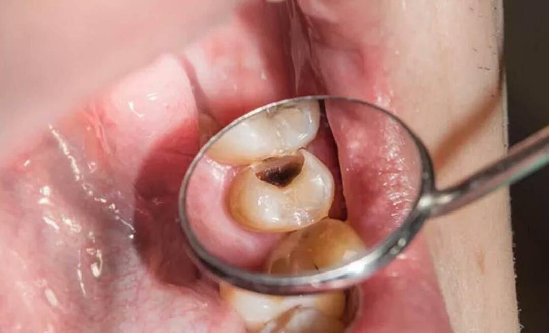 Prečo zuby hnijú a čo môžeme urobiť, aby sme tomu zabránili? 