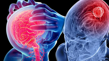 Čo je degenerácia mozgu (miechy)? Aké sú príznaky mozočka (miechy)?