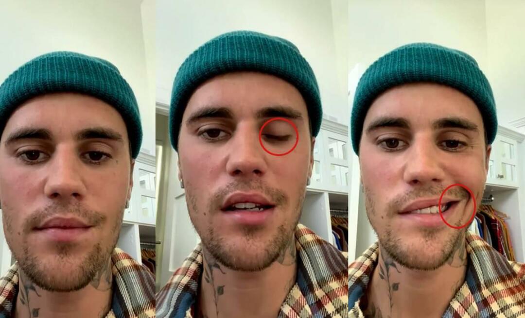 Justin Bieber mal paralýzu tváre! Slávna hviezda už raz nemôže vyraziť na svetové turné