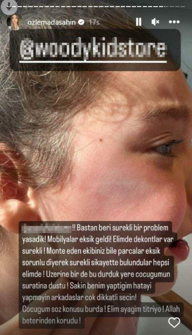 Dvere šatníka spadli na tvár dcéry Berkaya Şahina