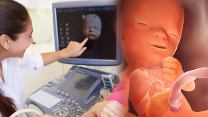 Ktorý orgán sa najskôr vyvíja u detí? Vývoj bábätka týždeň čo týždeň