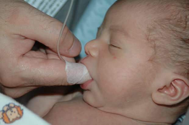 Čo je metóda kŕmenia prstom? Ako nakŕmiť dieťa striekačkou?