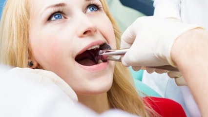 Je extrakcia zubov počas tehotenstva?