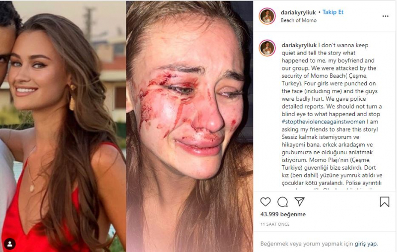 Daria Kyryliuk, popredná ukrajinská top modelka, ktorá údajne zaútočila na Izmir Çeşme, vystúpila po prvýkrát!