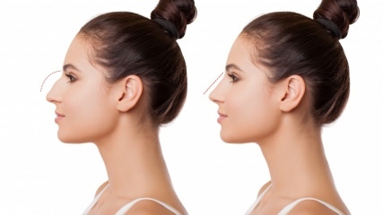 Ako sa vykonáva operácia nosa? V ktorých prípadoch sa vykonáva operácia nosa?