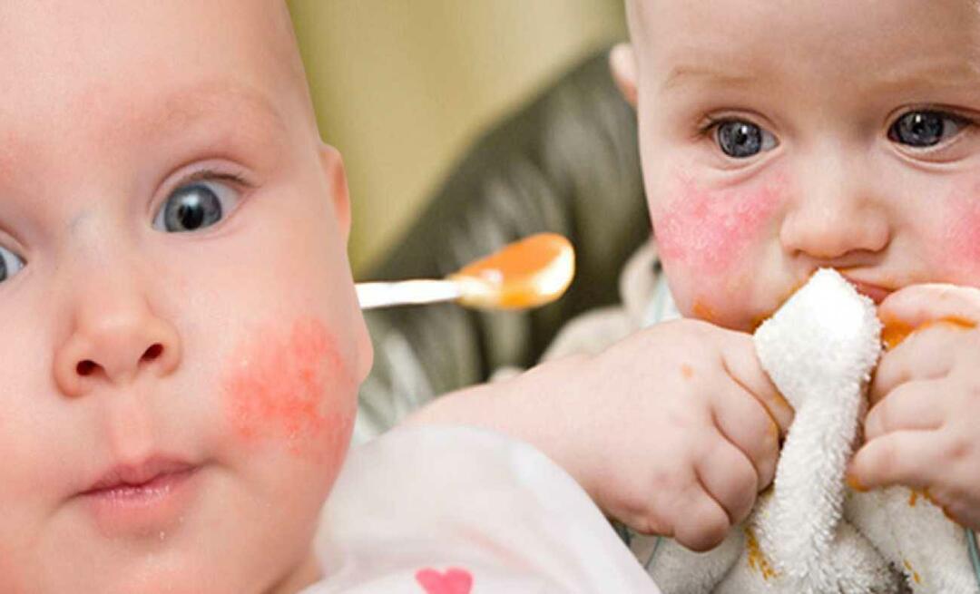 Čo by malo jesť dieťa s alergiou? Aké sú alternatívne potraviny pre alergické deti?