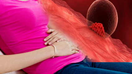 Čo je implantačné krvácanie počas tehotenstva? Ako odlíšiť implantačné krvácanie od menštruačného